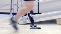 This unbelievable robotic-inspired Prosthetic promises Amputees An easier Stride