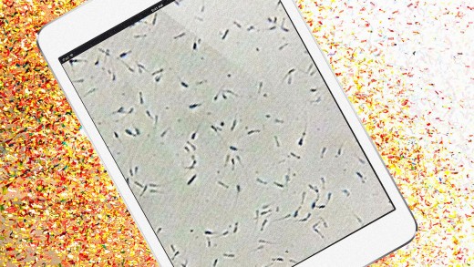 This device Helps Farmers by way of Turning iPads Into Sperm Analyzers