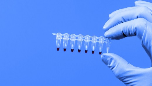 Theranos Caves To Critics, agrees To release data On Its Blood assessments