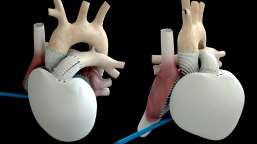 How close are we to the robotic human heart?