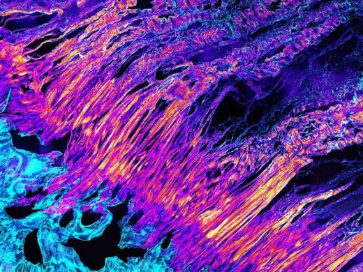 3D imaging reveals secret fibers that connect tendons to bone