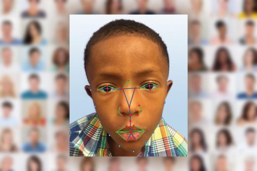Facial recognition will help doctors detect rare genetic disease