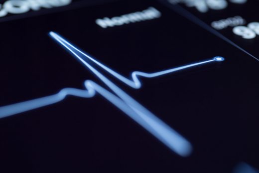 AI can predict heart attacks more accurately than doctors