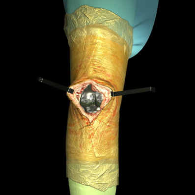 The Unreal, Bleeding-Edge Tech That's Helping Doctors Make The Cut | DeviceDaily.com