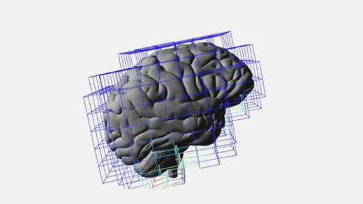 Brain Surgeons Are Basically Using Lego To Model Surgery