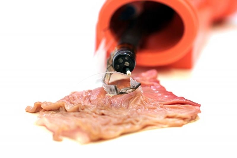 Harvard's tiny robotic arm can make endoscopic surgery safer | DeviceDaily.com