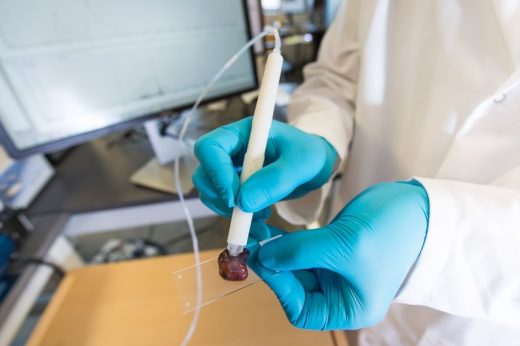 This pen can determine whether tissue is cancerous in ten seconds