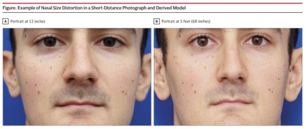 You were right: Your nose does look bigger in selfies. Here’s why | DeviceDaily.com