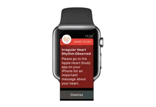 Stanford outlines its massive Apple Watch heart rate study
