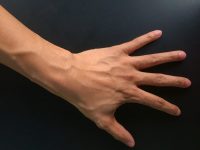 Hackers defeat vein authentication by making a fake hand
