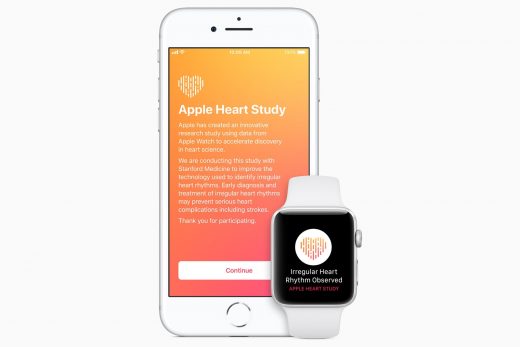 Stanford study finds Apple Watch can detect irregular heart rhythms