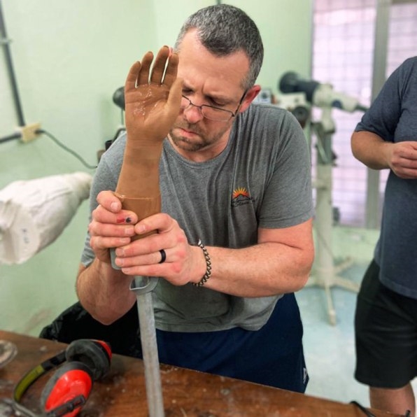 How 3D printing is making prosthetics cheap and accessible, even in remote places | DeviceDaily.com