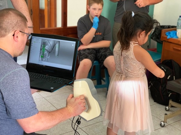 How 3D printing is making prosthetics cheap and accessible, even in remote places | DeviceDaily.com