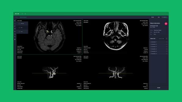 Soon you’ll be able to easily screen your brain for abnormalities—but should you? | DeviceDaily.com