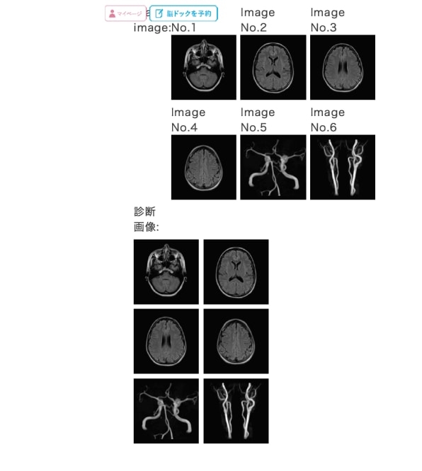 Soon you’ll be able to easily screen your brain for abnormalities—but should you? | DeviceDaily.com