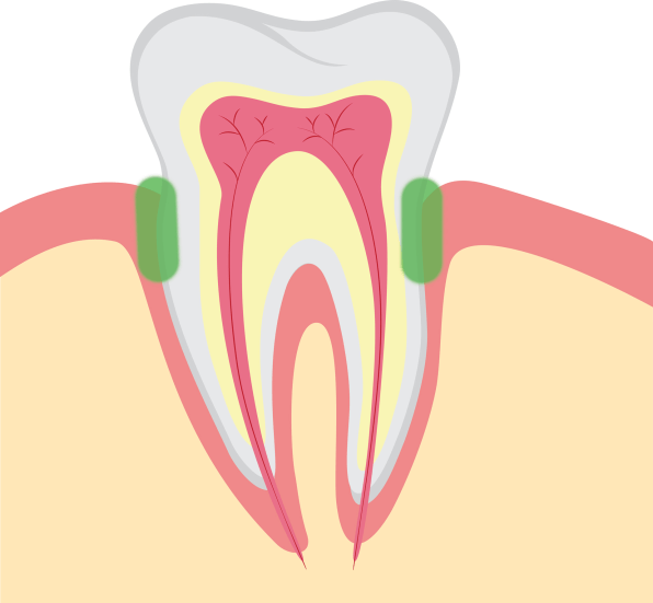 You’re not brushing your teeth enough. Three times a day keeps the heart attack away | DeviceDaily.com