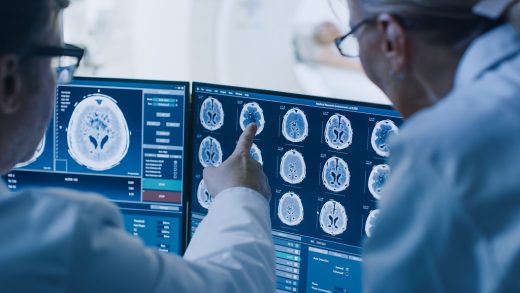 Intel and Penn Medicine are developing an AI to spot brain tumors