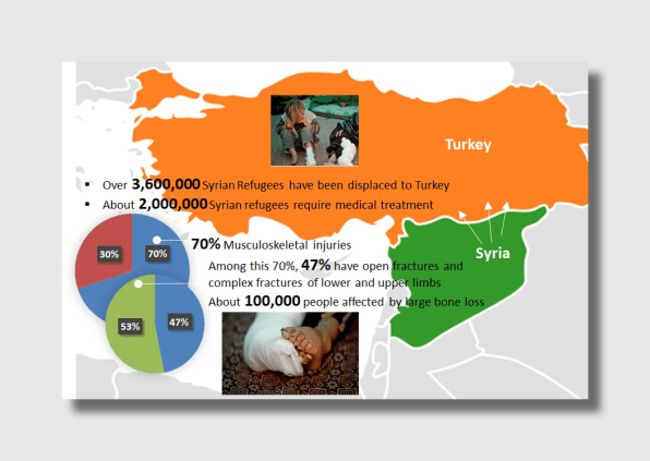 How 3D printing could help save lives in war-torn Syria | DeviceDaily.com