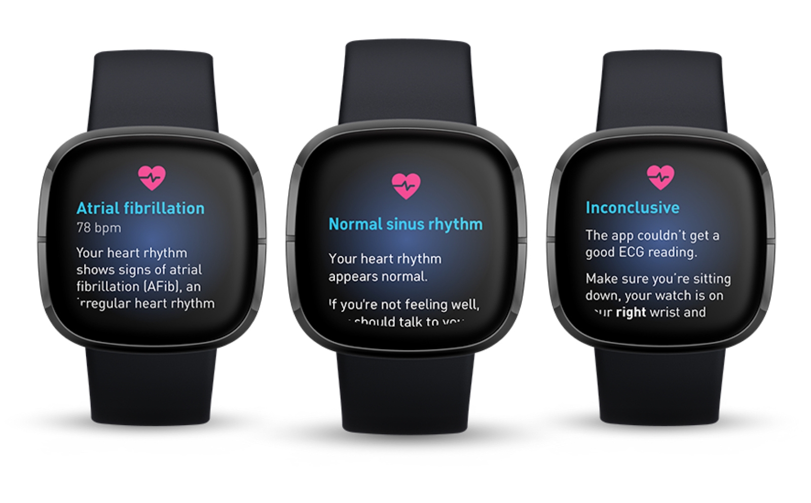 Fitbit's Sense smartwatch begins receiving ECG app update | DeviceDaily.com