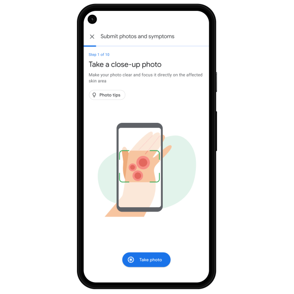Google’s new AI dermatologist can help you figure out what that mole is | DeviceDaily.com
