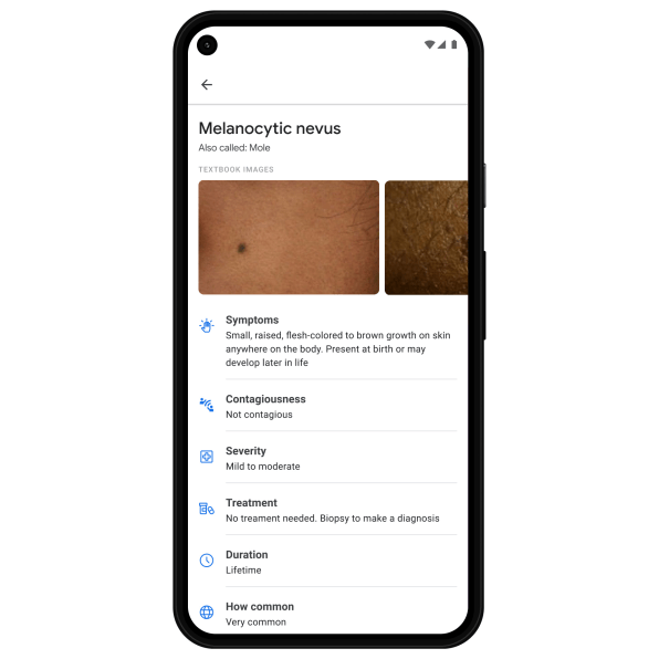 Google’s new AI dermatologist can help you figure out what that mole is | DeviceDaily.com