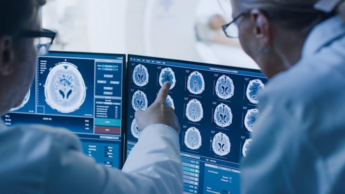 IBM's AI can predict how Parkinson's disease may progress in individuals | DeviceDaily.com