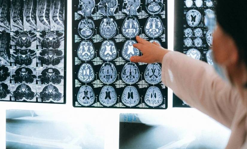 Internet of Medical Things: How Connected Devices are Changing Healthcare | DeviceDaily.com
