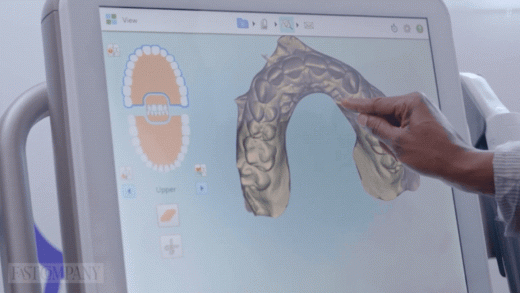 How invisible teeth aligners can help make more sustainable cars