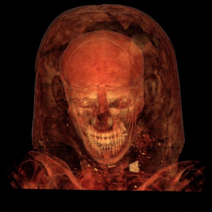 Researchers used CT scans to virtually unwrap a pristine mummy | DeviceDaily.com