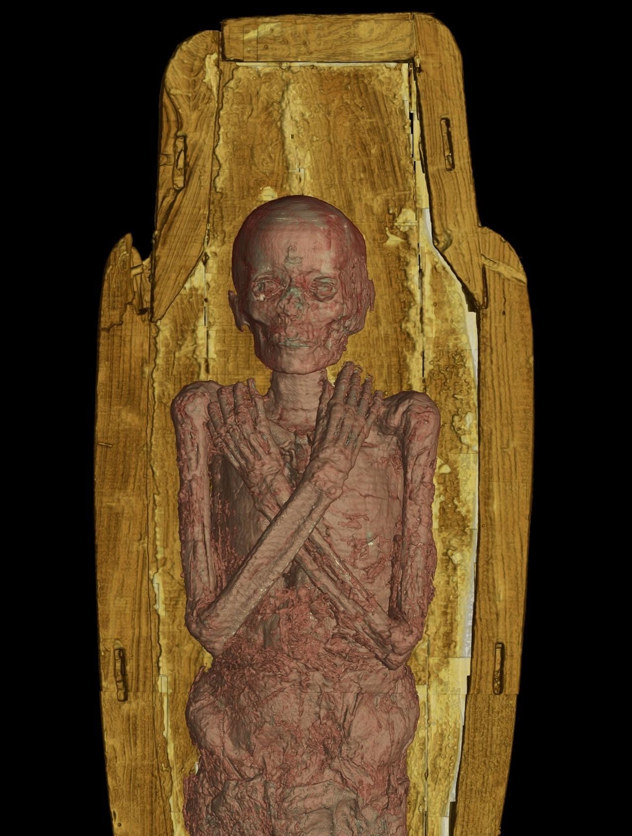 Researchers used CT scans to virtually unwrap a pristine mummy | DeviceDaily.com