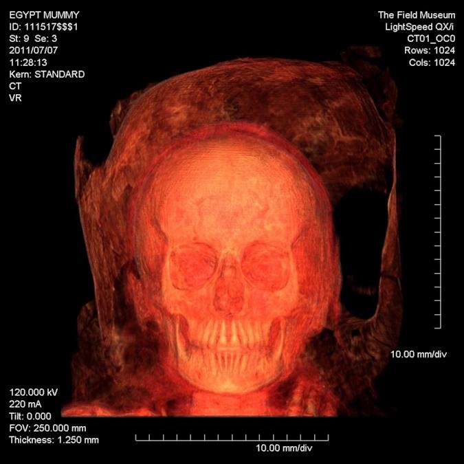 Researchers used CT scans to virtually unwrap a pristine mummy | DeviceDaily.com
