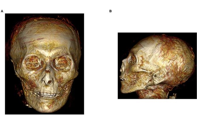 Researchers sequenced the genome of one of Pompeii’s ancient inhabitants | DeviceDaily.com