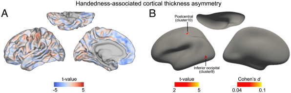 Why are some people left-handed? MRI brain scans are finally revealing an answer | DeviceDaily.com