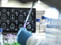 Researchers develop blood test that can reliably detect Alzheimer’s disease