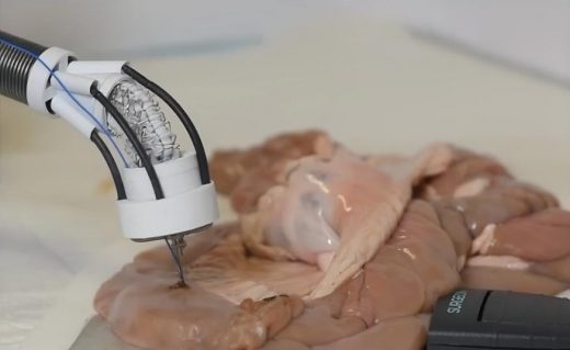 This insertable 3D printer will repair tissue damage from the inside