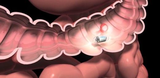 Scientists develop remote-controlled pill-shaped camera to diagnose digestive issues