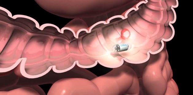 Scientists develop remote-controlled pill-shaped camera to diagnose digestive issues | DeviceDaily.com