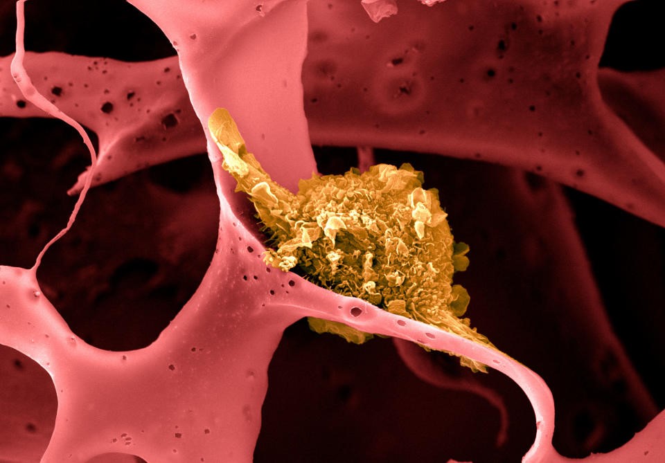 An experimental rice-sized implant monitors how drugs affect tumors | DeviceDaily.com