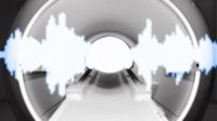 Prenuvo is bringing AI music to MRIs. Can it cure your claustrophobia?