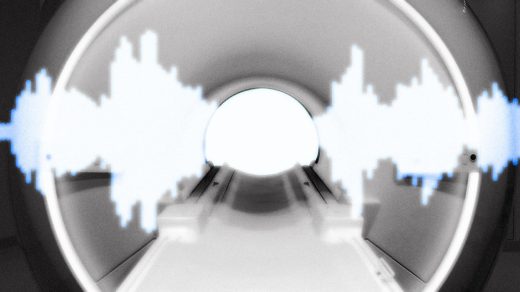 Prenuvo is bringing AI music to MRIs. Can it cure your claustrophobia?
