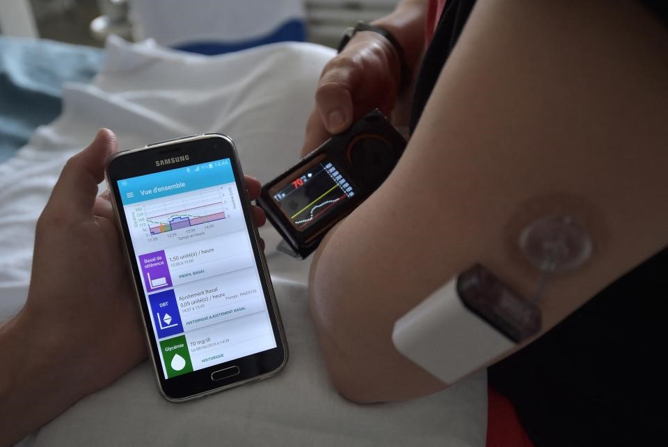 England’s NHS will provide artificial pancreas to thousands of diabetes patients | DeviceDaily.com