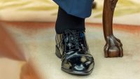 What is chronic venous insufficiency? Trump diagnosis puts the condition in the spotlight