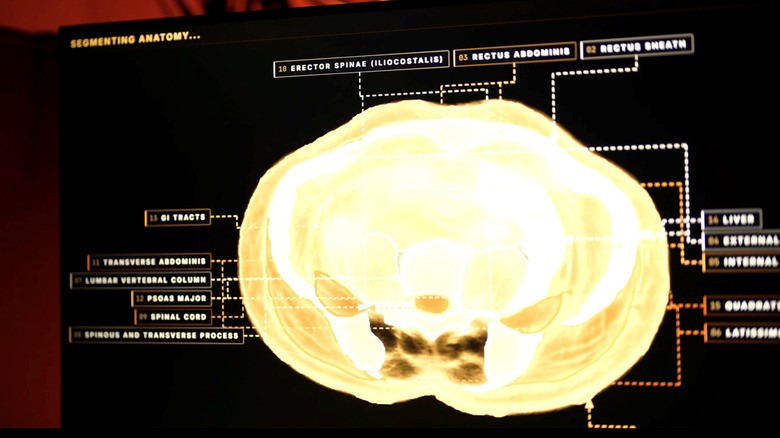Midjourney, the AI image generator, is developing a full-body ultrasonic scanner | DeviceDaily.com Midjourney, the AI image generator, is developing a full-body ultrasonic scanner | DeviceDaily.com